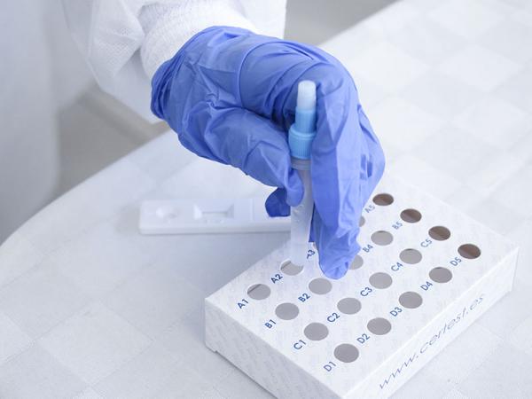 Puebla, sin casos de dengue en las últimas 24 horas: Salud