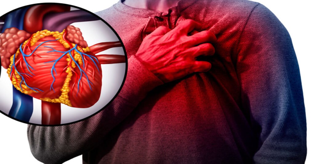 Hombre muere de infarto en Puebla