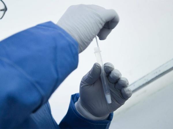 Puebla, sin nuevos contagios ni defunciones por dengue en últimas 24 horas: Salud